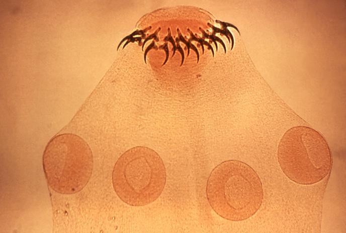 Taenia_solium_tapeworm_scolex_with_its_four_suckers_and_two_rows_of_hooks_5262_lores.jpg